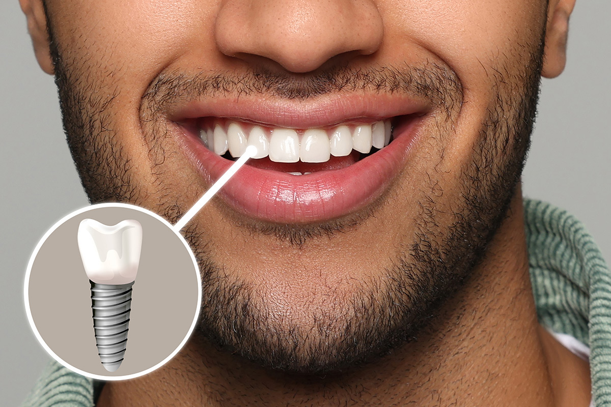 WPB Dental & Implants | Carolina Roots